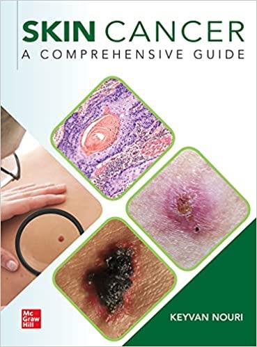 Skin Cancer A Comprehensive Guide