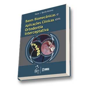 Bases Biomecanicas E Aplicações Clínicas Em Ortodontia Interceptativa