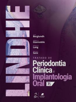 Tratado De Peridontia Clínica E Implantologia Oral