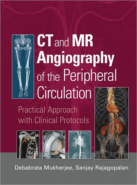 Ct & Mr Angiography Peripheral Circulation Practice