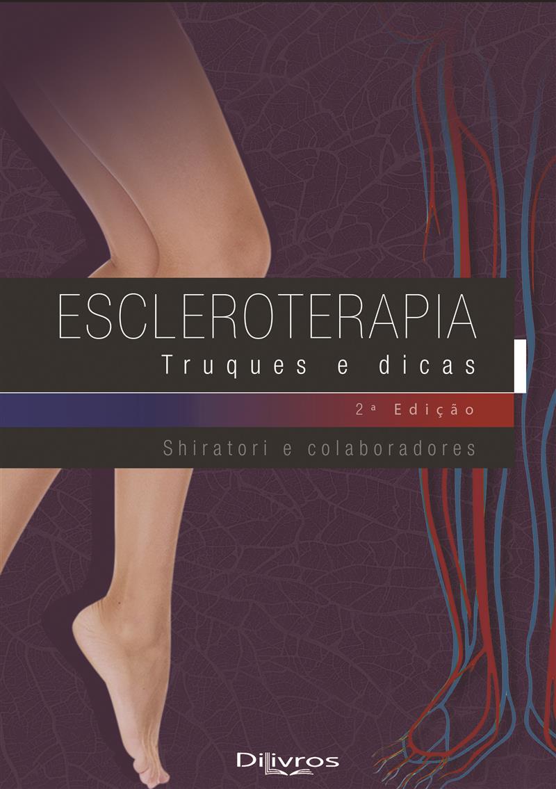 Escleroterapia Truques E Dicas