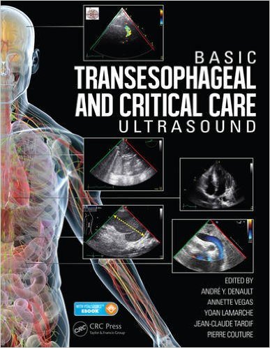 Basic Transesophageal And Critical Care Ultrasonography