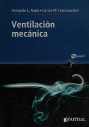 Ventilacion Mecanica