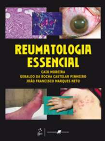 Reumatologia Essencial