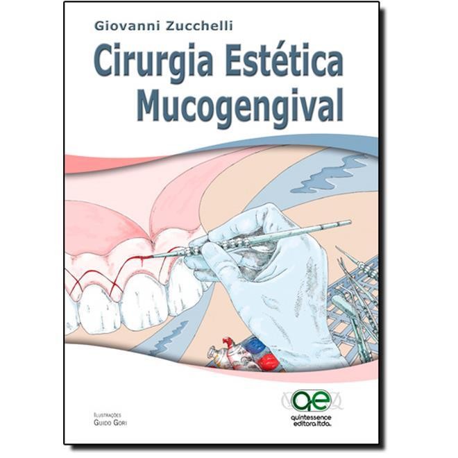 Cirurgia Estética Mucogengival