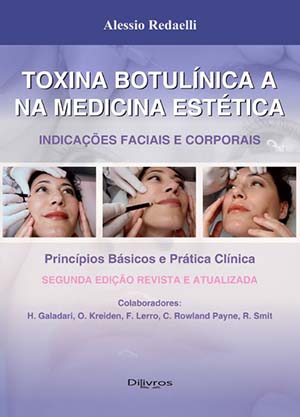 Toxina Botulinica A Na Medicina Estetica Indicacoes Faciais E Corporais