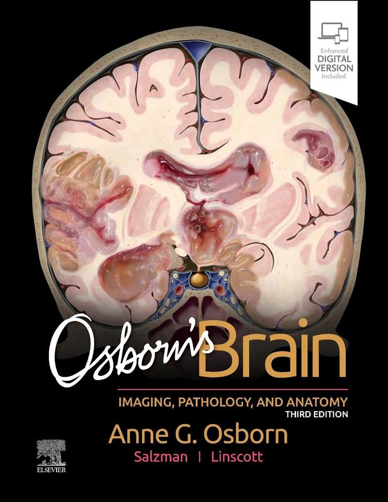 Brain - Imaging, Pathology And Anatomy