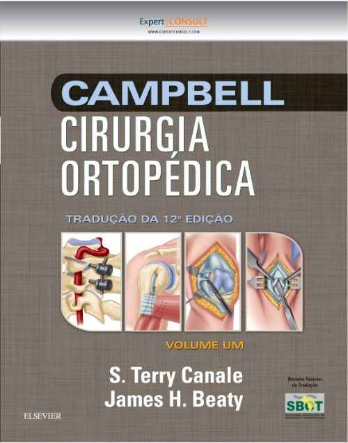 Campbell Cirurgia Ortopedica