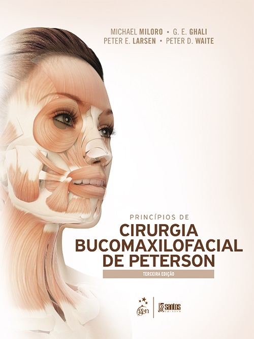 Principios De Cirurgia Bucomaxilofacial De Peterson