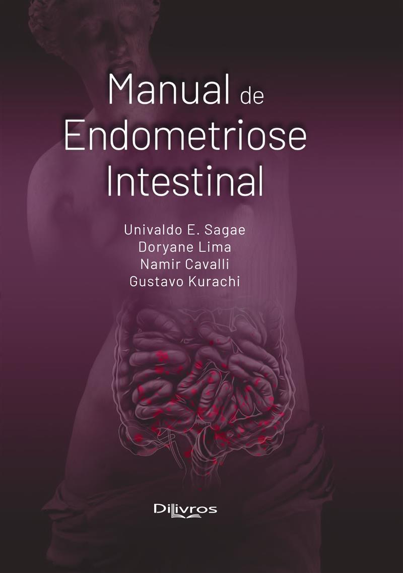 Manual De Endometriose Intestinal