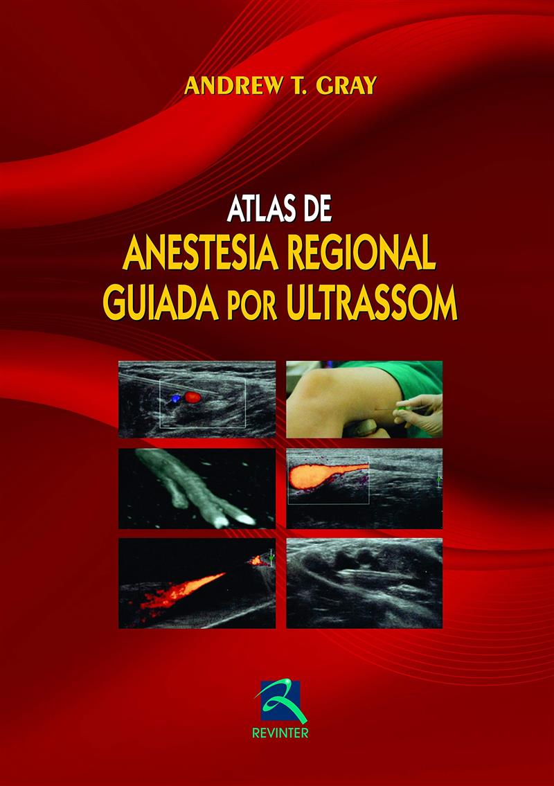 Atlas De Anestesia Regional Guiada Por Ultrason