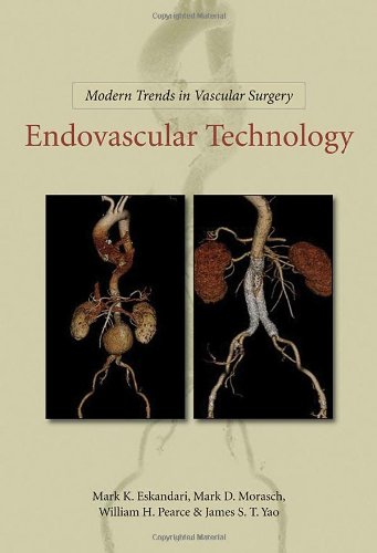 Modern Trends In Vascular Surgery: Endovascular Technology