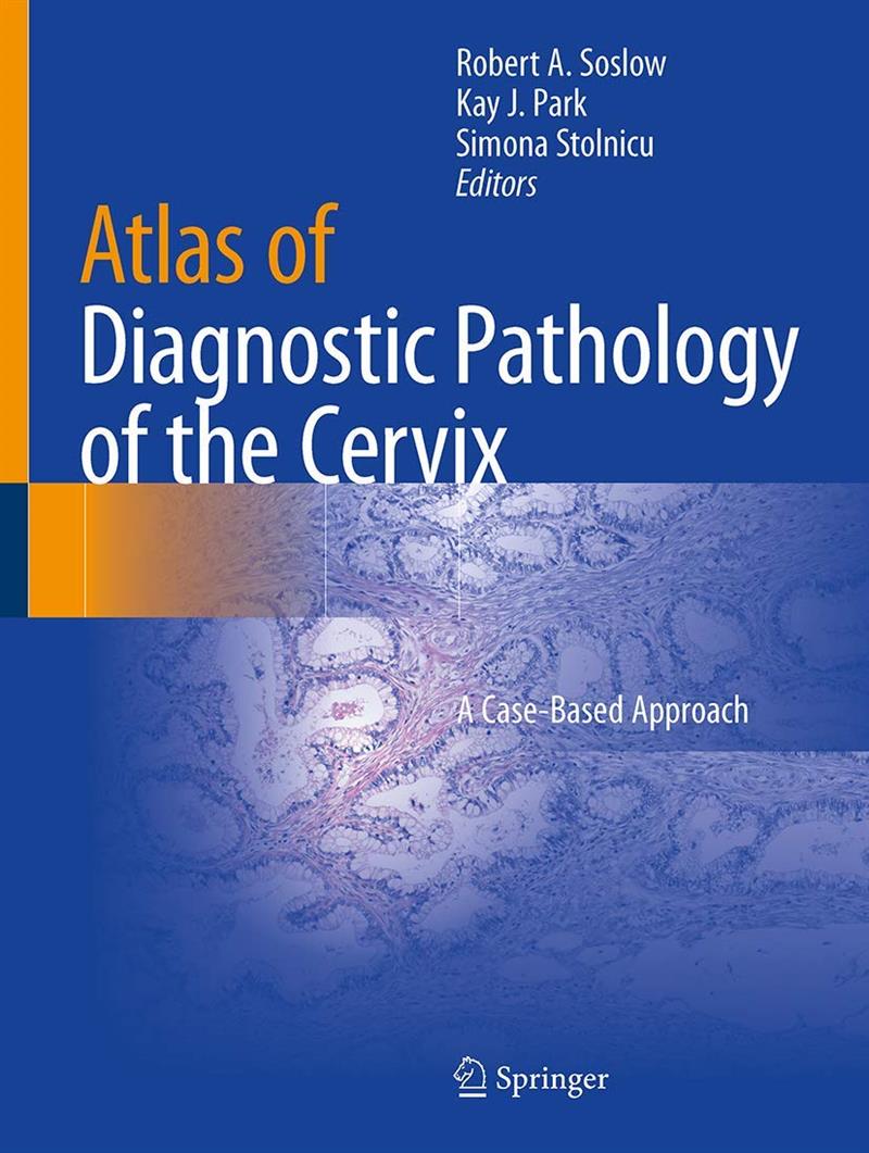 Atlas Of Diagnostic Pathology Of The Cervix (capa Dura)