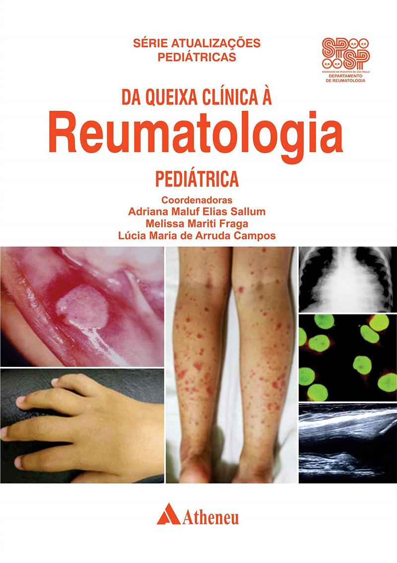 Da Queixa Clinica A Reumatologia Pediatrica