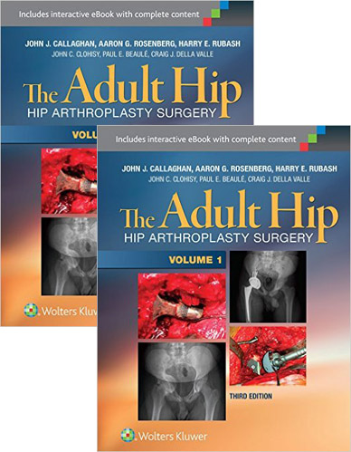 The Adult Hip: Arthroplasty And Its Alternatives