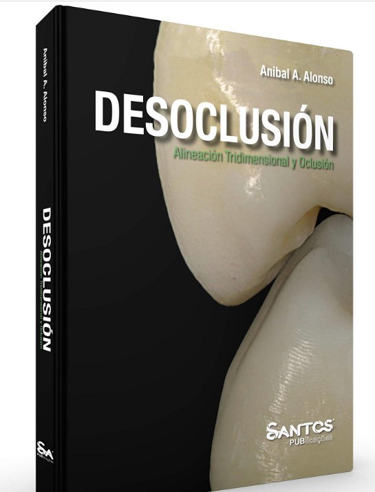 Desoclusión Alineación Tridimensional Y Oclusión (espanhol)