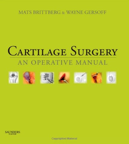 Cartilage Surgery - An Operative Manual, Expert Consult: Online And Print