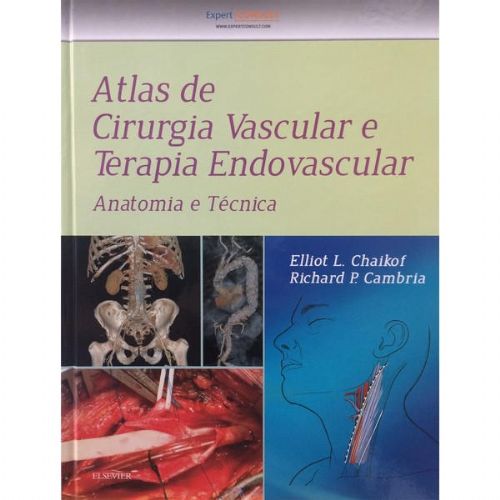 Atlas De Cirurgia Vascular E Terapia Endovascular