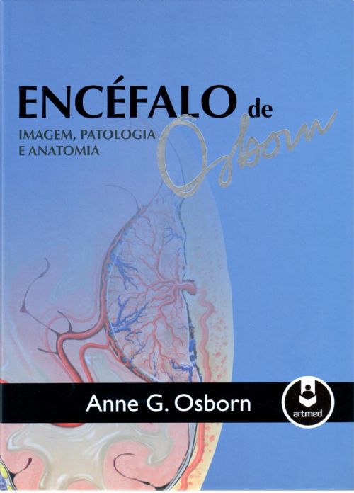 Encefalo De Osborn - Imagem, Patologia E Anatomia