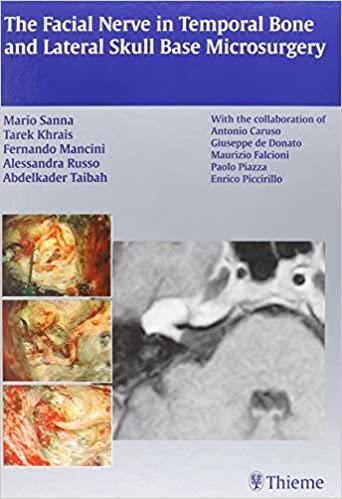 The Facial Nerve In Temporal Bone And Lateral Skull Base Microsurgery