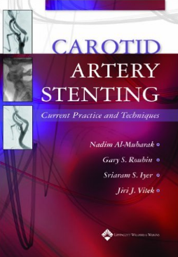 Carotid Artery Stenting: Current Practice And Techniques