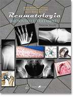 Reumatologia: Diagnóstico E Tratamento