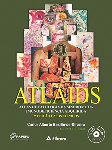 Atlaids - Atlas De Patologia Da Síndrome Da Imunodeficiência Adquirida (aids/hiv) 2a Edição - Casos