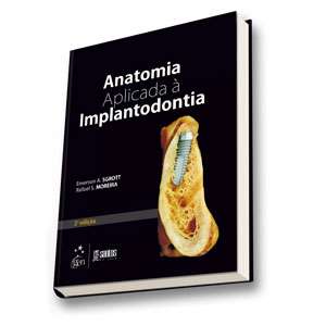 Anatomia Aplicada À Implantodontia
