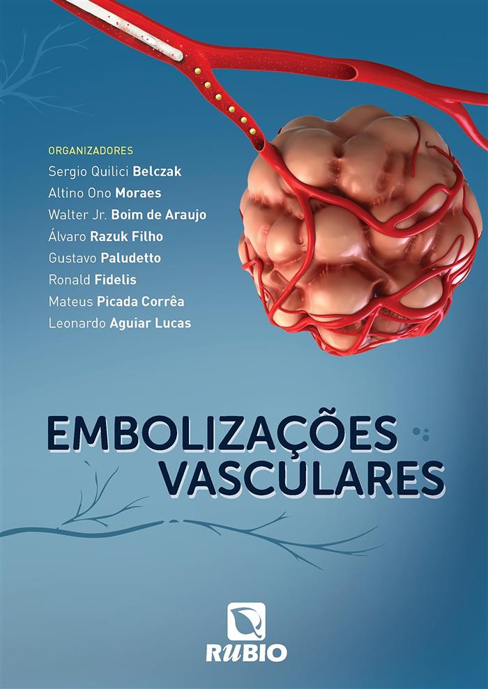Embolizacoes Vasculares