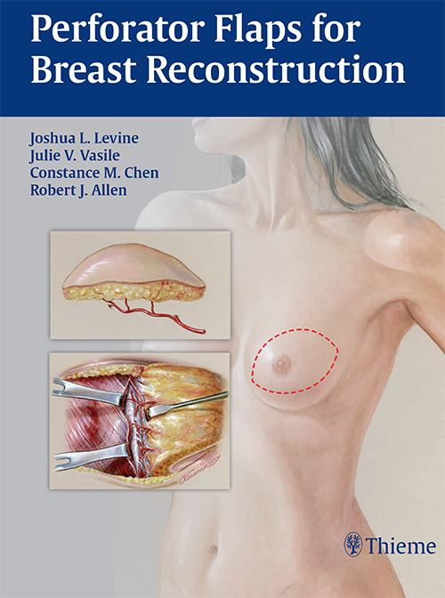 Perforator Flaps For Breast Reconstruction
