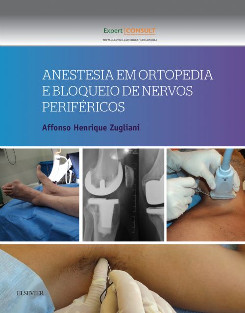 Anestesia Em Ortopedia E Bloqueio De Nervos Perifericos