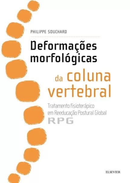Deformações Morfológicas Da Coluna Vertebral - Tratamento Fisioterápico Em Rpg