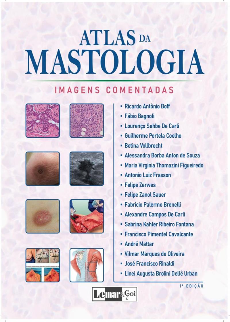 Atlas Da Mastologia
