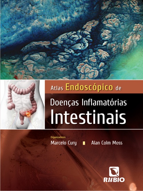 Atlas Endoscópico De Doenças Inflamatórias Intestinais
