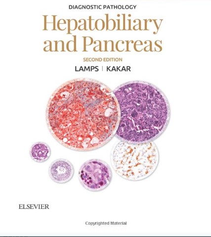 Diagnostic Pathology: Hepatobiliary And Pancreas