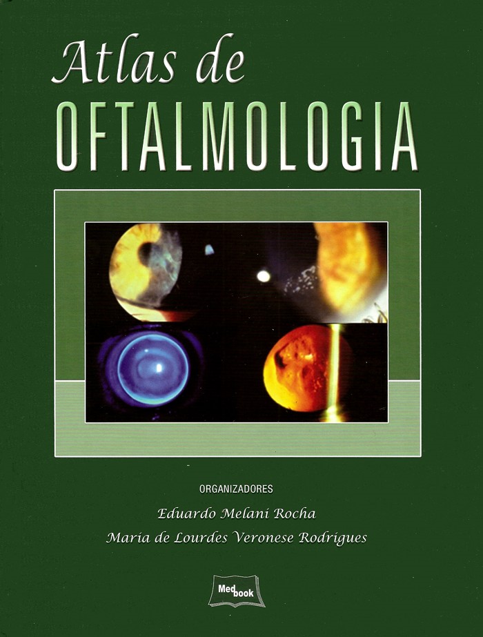 Atlas De Oftalmologia