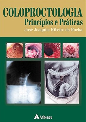 Coloproctologia Princípios E Práticas