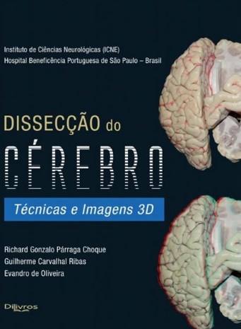Disseccao Do Cerebro Tecnicas E Imagens 3d