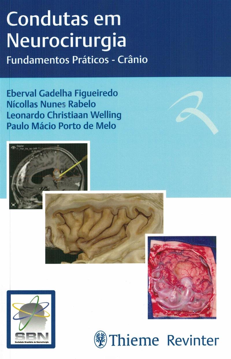 Condutas Em Neurocirurgia Fund Praticos Cranio