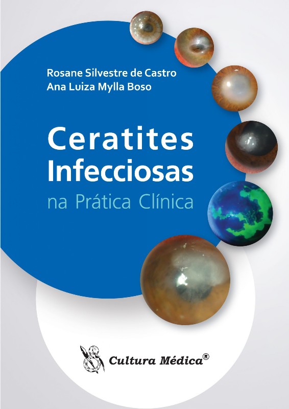 Ceratites Infecciosas Na Pratica Clinica