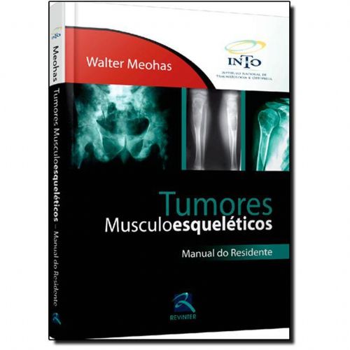 Tumores Musculoesqueleticos - Manual Do Residente