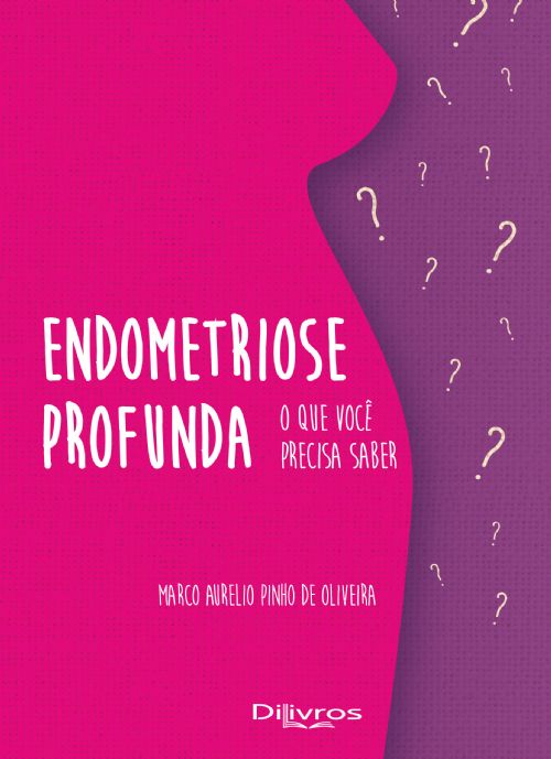 Endometriose Profunda O Que Voce Precisa Saber