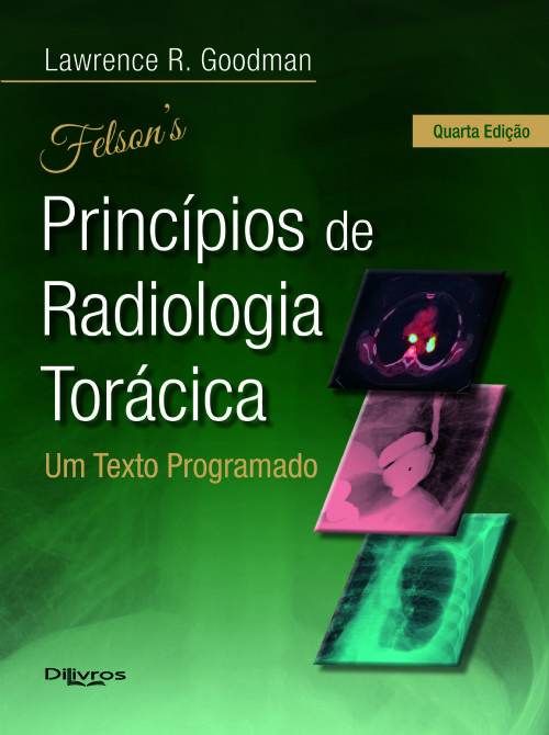 Felson Principios De Radiologia Toracica