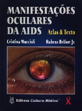 Manifestacoes Oculares Da Aids Atlas E Texto