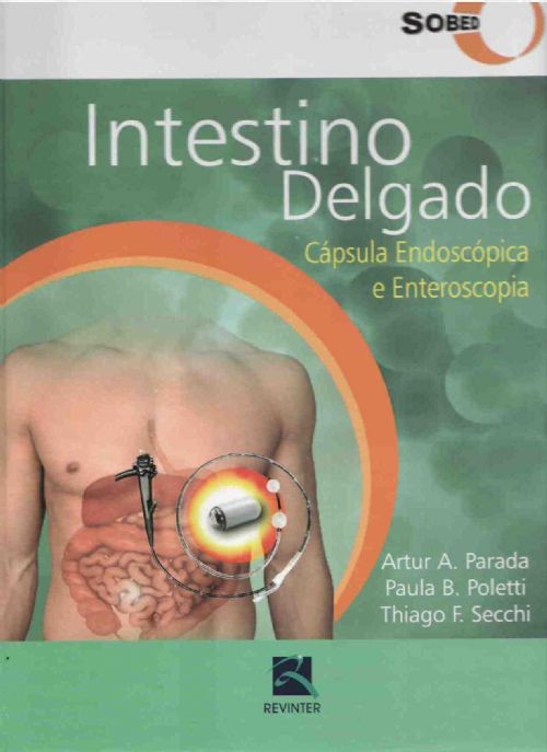 Intestino Delgado: Capsula Endoscopica E Enteroscopia