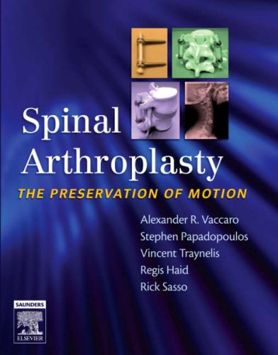 Spinal Arthroplasty The Preservation Of Motion With Dvd