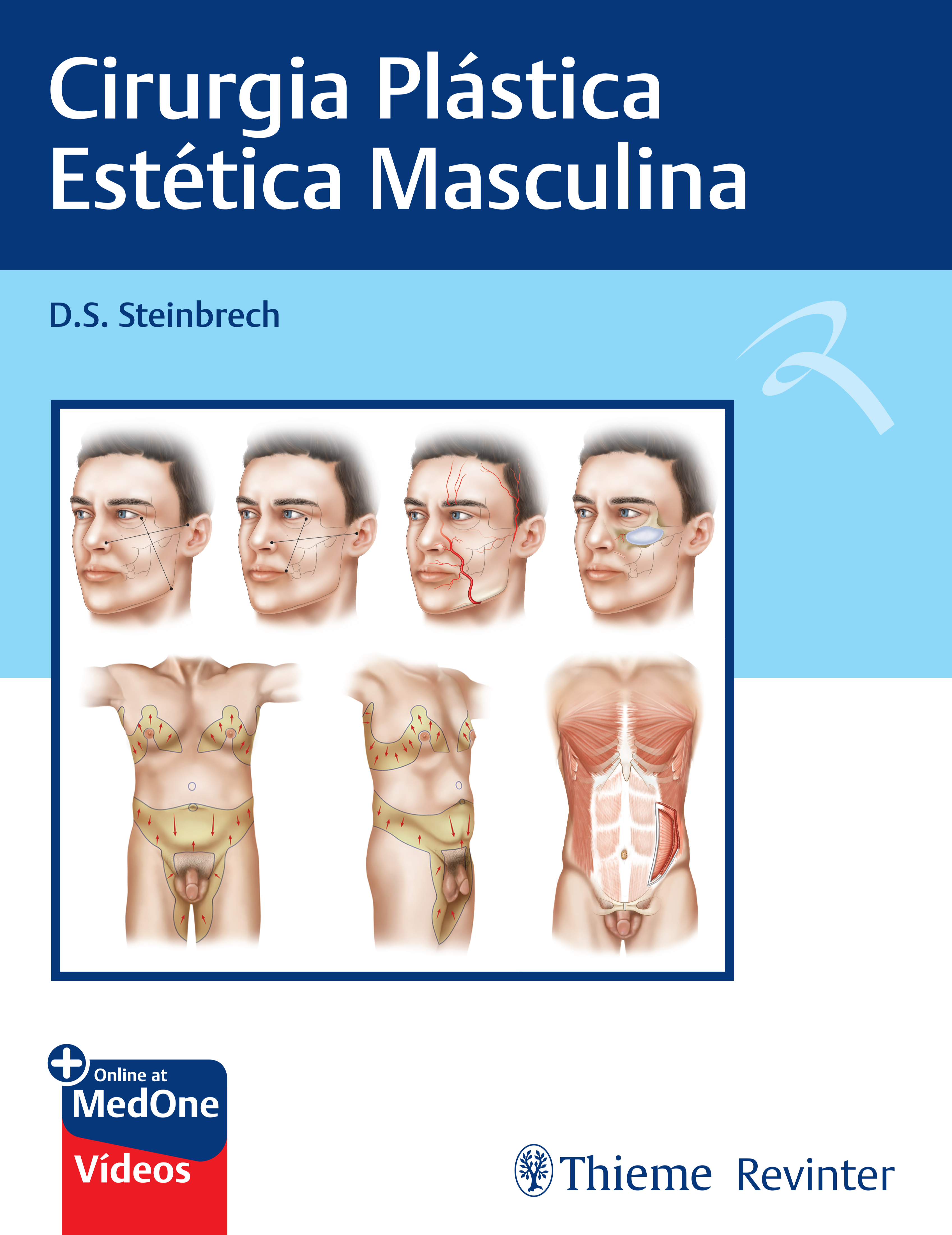 Cirurgia Plastica Estetica Masculina