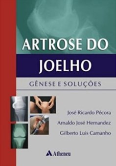 Artrose Do Joelho