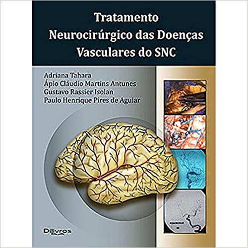 Tratamento Neurocirurgico Das Doencas Vasculares Do Snc