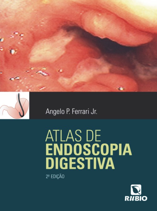 Atlas De Endoscopia Digestiva